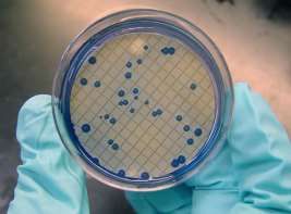 Colonis of fecal cliform bacteria